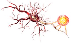 Esclerose múltipla: quando o formigamento é uma campainha de alarme
